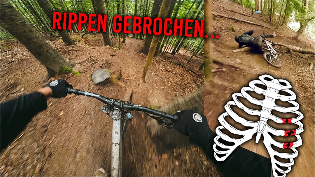 Rippen Gebrochen… Chatel Bikepark nach Morzine!